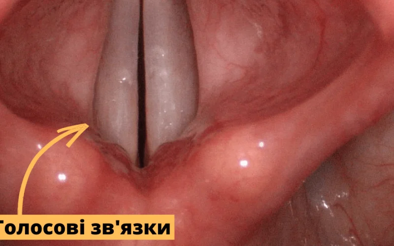 Голосові зв’язки – це: як працює наш голос